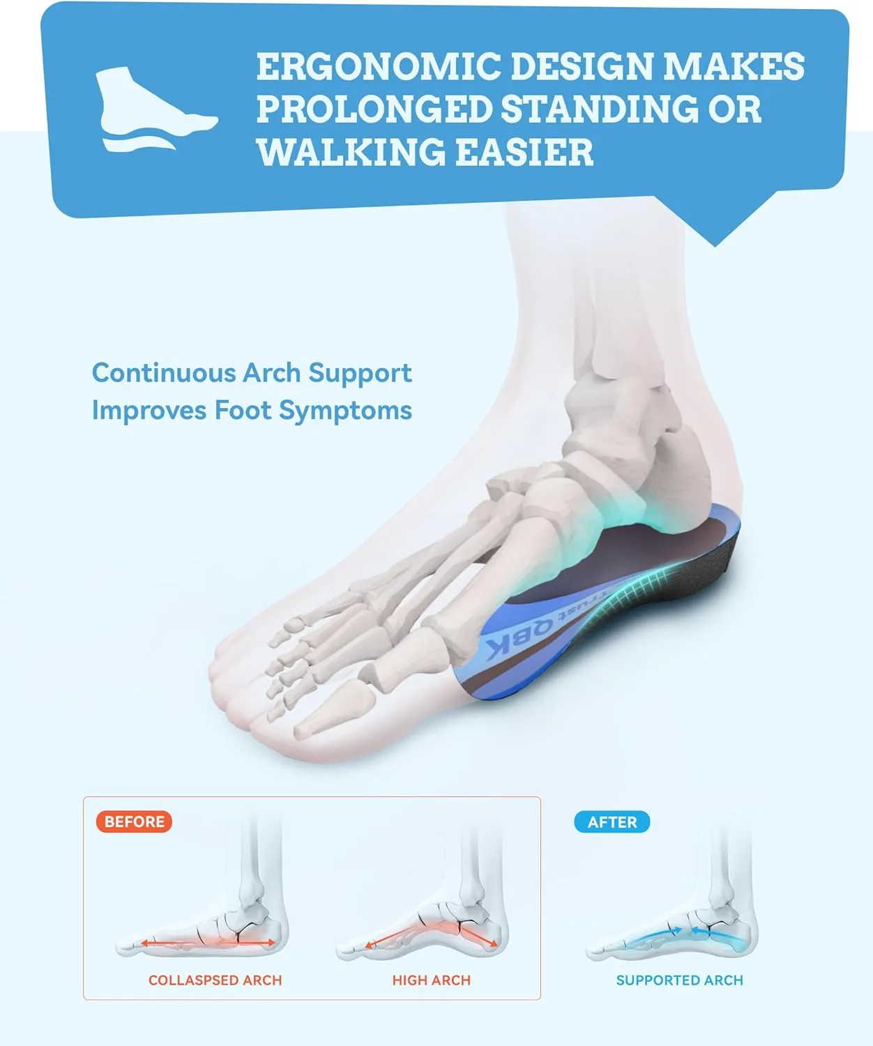 Arch Support Inserts, QBK Metatarsalgia Insoles, Men's Orthopedic Insoles, High Arch Support for Plantar Fasciitis, Flat Foot Metatarsal Bone Pain, Varus Foot XL