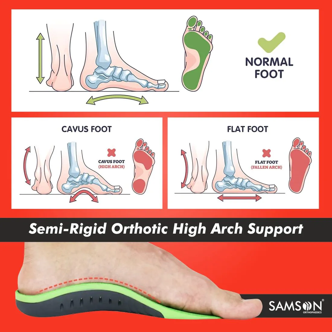 SAMSON 3/4 Orthotic Insole with Arch Support